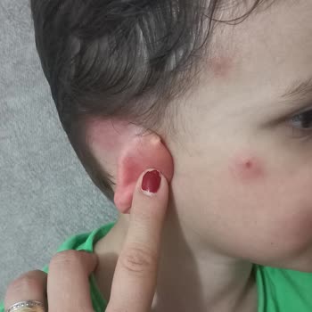 İzmir Büyükşehir Belediyesi Böcek Ve Sivri Sinekler İçin İlaçlama Eksikliği