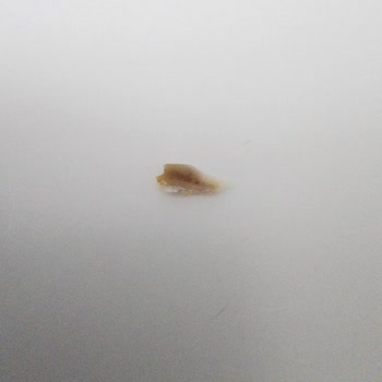 Gedik Piliç Gedik Ürününden Çıkan Kemik Parçası