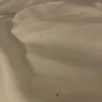 Cityloft 64 Oda Pis Her Şey Kırık