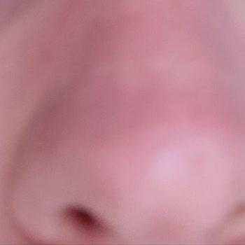 Cire Aseptine Güneş Koruyucu Kızarıklık Yapıyor