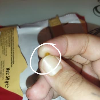 Ülker Ürünlerinde Sorun Var