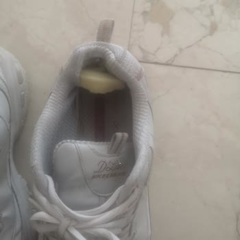 Parçalanmaya Başlayan Sketchers Ayakkabım