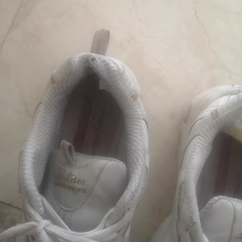 Parçalanmaya Başlayan Sketchers Ayakkabım