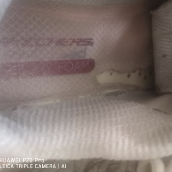 Parçalanmaya Başlayan Sketchers Ayakkabım