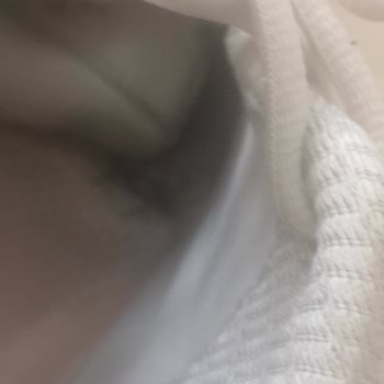 Parçalanmaya Başlayan Sketchers Ayakkabım