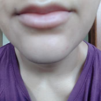 Time Esthetic Dudak Dolgusu Hiç Yapılmamış