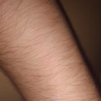 Eczacıbaşı E-Sanal Mağaza Defans Sinek Kovucu Vücudumu Kaşıntıdan Mahvetti. Harita Gibi Yaptı.