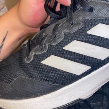 adidas Ayakkabının Çok Kısa Sürede Yırtılması