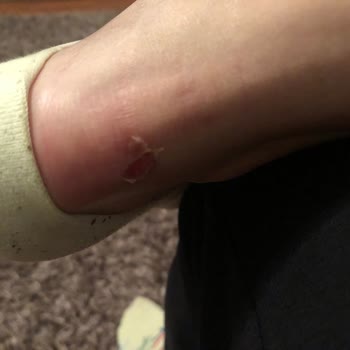 Skechers Ayakkabıdan Beklediğimden Farklı Bir Deneyim