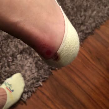 Skechers Ayakkabıdan Beklediğimden Farklı Bir Deneyim