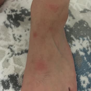 Ahmet İpek Sucukları Gıda Zehirlenmesi