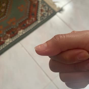 Nascita Takma Tırnak Kabusu