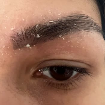 Serap Çınar Akasya Kaş Vitamin Sorunu