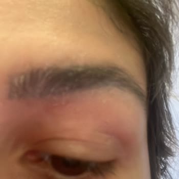 Serap Çınar Akasya Kaş Vitamin Sorunu