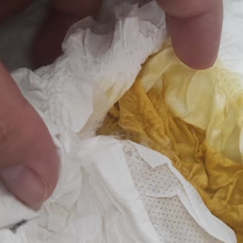 Sleepy Bebek Bezi Değil Resmen Yapıştırmalı Ped, Taşırıyor Ve İnce