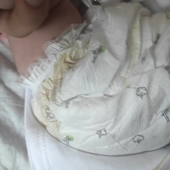 Sleepy Bebek Bezi Değil Resmen Yapıştırmalı Ped, Taşırıyor Ve İnce