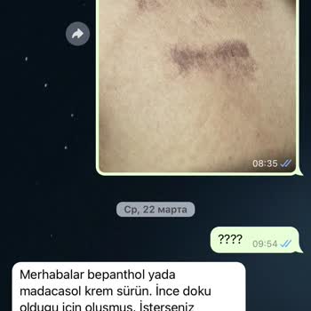 Popüler Güzellik Salonu Epilasyon Vücut Yanması