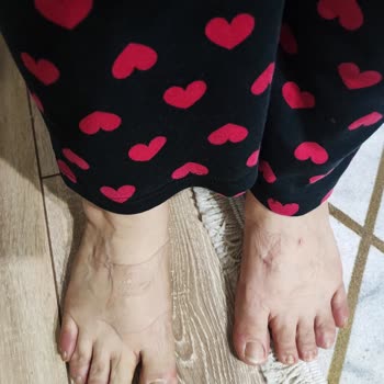 Hotiç Ayakkabı Deri Terlik İadesini İstiyorum Zımbaları Ayak Üstünü Vuruyor