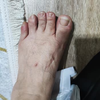 Hotiç Ayakkabı Deri Terlik İadesini İstiyorum Zımbaları Ayak Üstünü Vuruyor