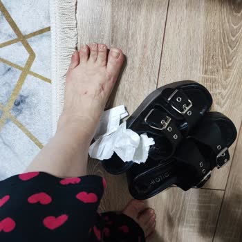 Hotiç Ayakkabı Deri Terlik İadesini İstiyorum Zımbaları Ayak Üstünü Vuruyor