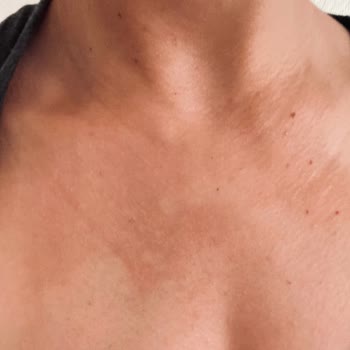 Garnier Ambre Solaire İdeal Bronzluk Bronzlaştırıcı Yağ Cildimi Yaktı.