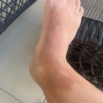 Garnier Ambre Solaire İdeal Bronzluk Bronzlaştırıcı Yağ Cildimi Yaktı.