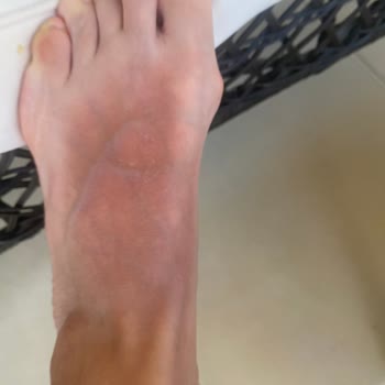 Garnier Ambre Solaire İdeal Bronzluk Bronzlaştırıcı Yağ Cildimi Yaktı.