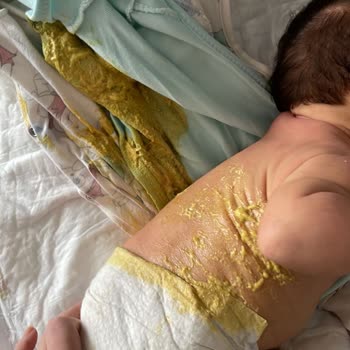 Prima Premium Care Kakayı Sırtından Taşırıyor