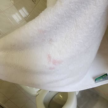 Royal Park Otel Artemisia Club Otelin Ücretine Asla Layık Olmayışı