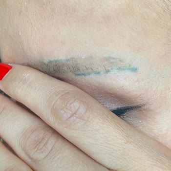 Bahar Babacan Beauty Center Kaş İşlemi