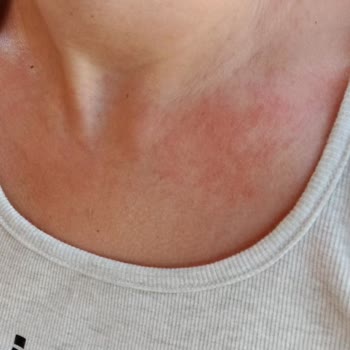 Eda Taşpınar Bomba Beni Mahvetti