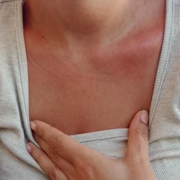 Eda Taşpınar Bomba Beni Mahvetti