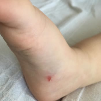 FLO Ayakkabı FLO İnternet Sitesinden Aldığım Sandaletler