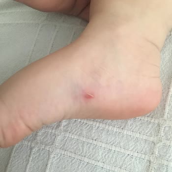 FLO Ayakkabı FLO İnternet Sitesinden Aldığım Sandaletler