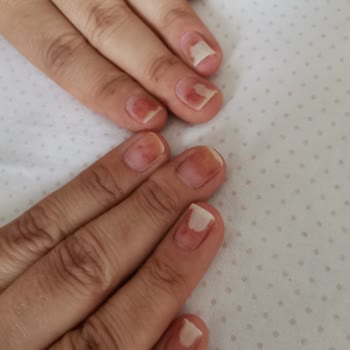 Esma Sema Güzellik Salonu Kalıcı Oje Şikayeti