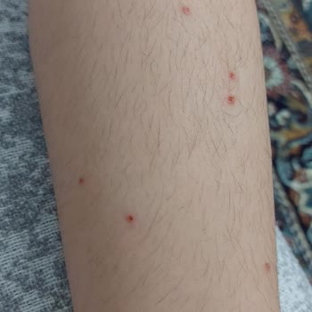 İzmir Büyükşehir Belediyesi Hamam Böceği Ve Sivrisineklerin İlaçlanmaması