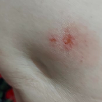 İzmir Büyükşehir Belediyesi Hamam Böceği Ve Sivrisineklerin İlaçlanmaması