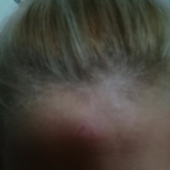 Palette Saç Derim Yandı