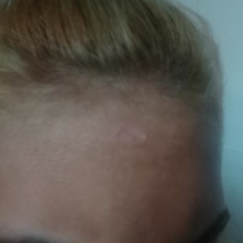 Palette Saç Derim Yandı