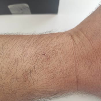 Huawei Saat Kolumu Yara Yaptı.