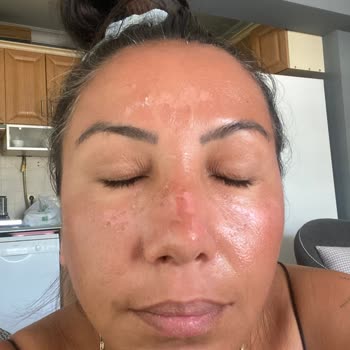 Sinoz Yüzümü Mahvetti Sizin Kusursuz Dediğiniz Ürün