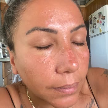 Sinoz Yüzümü Mahvetti Sizin Kusursuz Dediğiniz Ürün