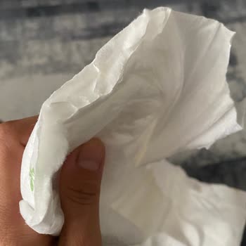 Baby Turco Bebek Bezi Yırtık