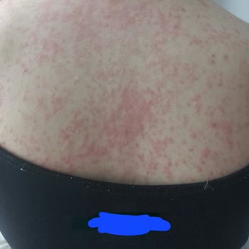 Bilim İlaç Gemiloks 320 7 Tablet