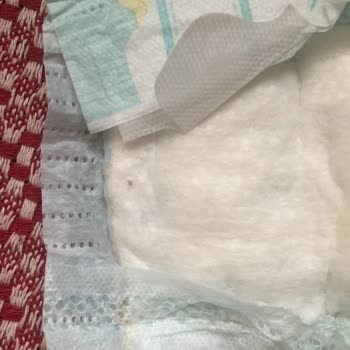 Prima Yabancı Madde Olması