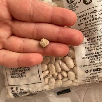 Yayla Bakliyat Yayla Dermason Fasulyeden Taş Çıktı