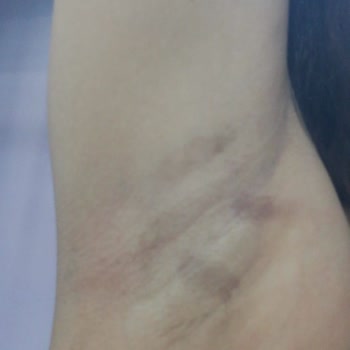 Sandra Güzellik Ve Epilasyon Salonu Eşimi Közlenmiş Bibere Beni De Közlenmiş Patlıcana Çevirdi