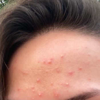 Yves Rocher Elixir Botanique Alerji!