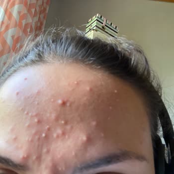 Yves Rocher Elixir Botanique Alerji!