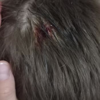 Kentpark Macera Adası Yaralanan Çocuk